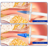 Fültisztító eszköz, fülzsír eltávolításához, tartozékokkal, hasizmokból és PC-ből készült
